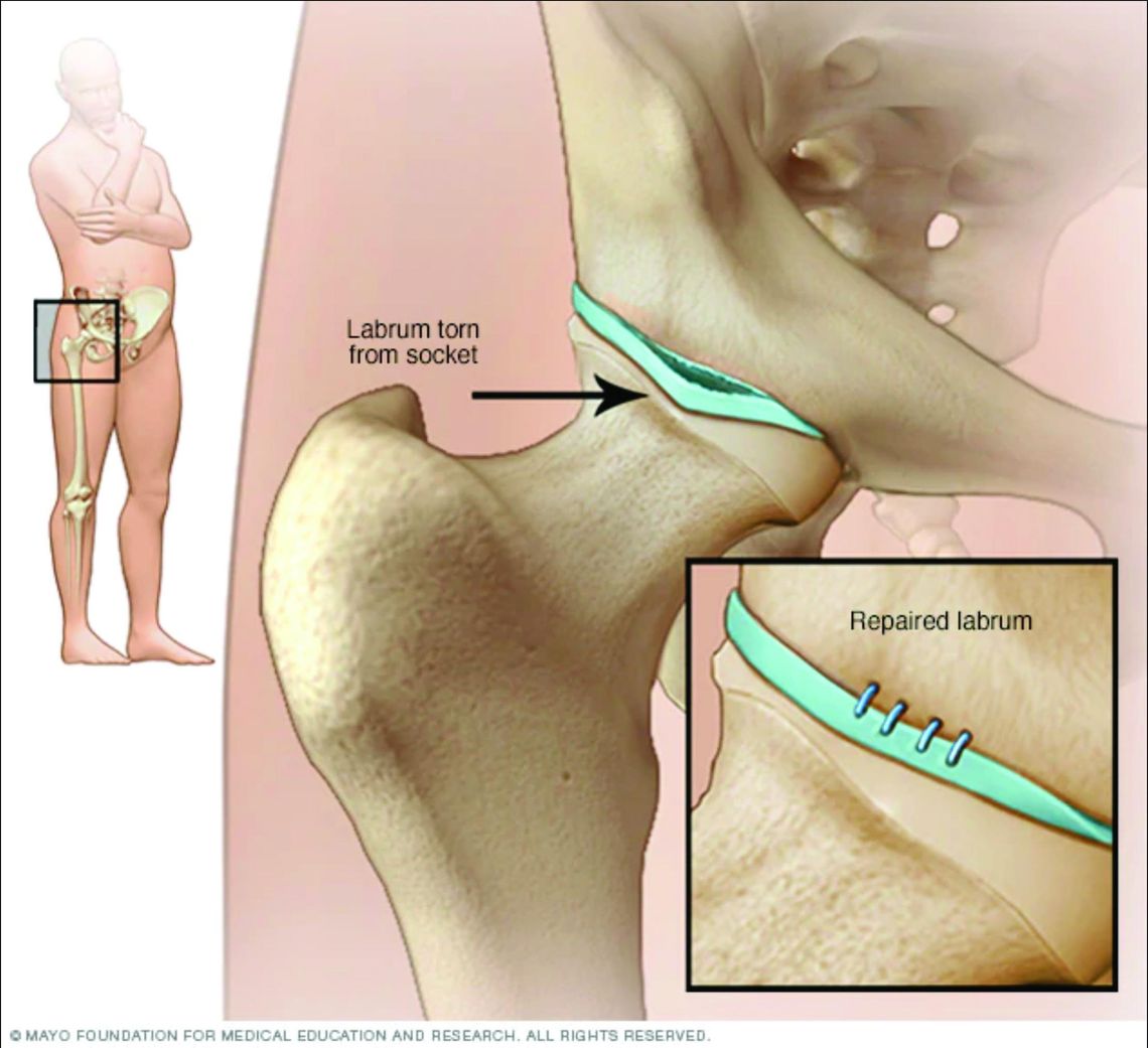 The power of tissue donation